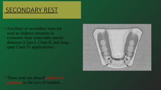 Long Box Rests For Rotational Path Rpd REST AND REST SEAT in dentistry in rpd.pptx