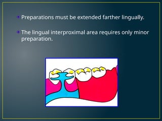 Interproximal Rest Rpd Rest and Rest Seat in Removable partial denture | PPTX