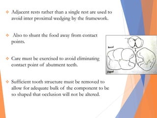  Adjacent rests rather than a single rest are used to
avoid inter proximal wedging by the framework.
 Also to shunt the food away from contact
points.
 Care must be exercised to avoid eliminating
contact point of abutment teeth.
 Sufficient tooth structure must be removed to
allow for adequate bulk of the component to be
so shaped that occlusion will not be altered.
 