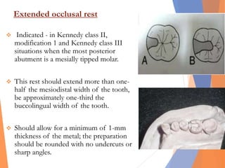 Extended occlusal rest
 Indicated - in Kennedy class II,
modification 1 and Kennedy class III
situations when the most posterior
abutment is a mesially tipped molar.
 This rest should extend more than one-
half the mesiodistal width of the tooth,
be approximately one-third the
buccolingual width of the tooth.
 Should allow for a minimum of 1-mm
thickness of the metal; the preparation
should be rounded with no undercuts or
sharp angles.
 