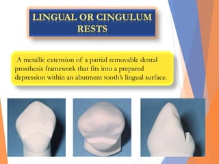 A metallic extension of a partial removable dental
prosthesis framework that fits into a prepared
depression within an abutment tooth’s lingual surface.
 