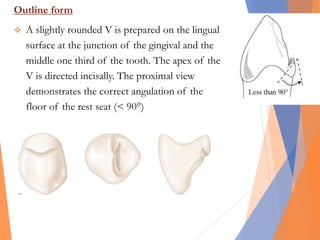 Outline form
 A slightly rounded V is prepared on the lingual
surface at the junction of the gingival and the
middle one third of the tooth. The apex of the
V is directed incisally. The proximal view
demonstrates the correct angulation of the
floor of the rest seat (< 90°)
 