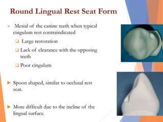 Round Lingual Rest Seat Form
 Mesial of the canine teeth when typical
cingulum rest contraindicated
 Large restoration
 Lack of clearance with the opposing
teeth
 Poor cingulum
 Spoon shaped, similar to occlusal rest
seat.
 More difficult due to the incline of the
lingual surface.
 