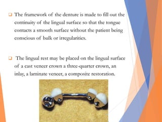  The framework of the denture is made to fill out the
continuity of the lingual surface so that the tongue
contacts a smooth surface without the patient being
conscious of bulk or irregularities.
 The lingual rest may be placed on the lingual surface
of a cast veneer crown a three-quarter crown, an
inlay, a laminate veneer, a composite restoration.
 