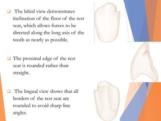  The labial view demonstrates
inclination of the floor of the rest
seat, which allows forces to be
directed along the long axis of the
tooth as nearly as possible.
 The proximal edge of the rest
seat is rounded rather than
straight.
 The lingual view shows that all
borders of the rest seat are
rounded to avoid sharp line
angles.
 