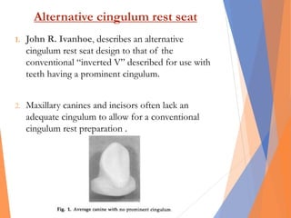 Alternative cingulum rest seat
1. John R. Ivanhoe, describes an alternative
cingulum rest seat design to that of the
conventional “inverted V” described for use with
teeth having a prominent cingulum.
2. Maxillary canines and incisors often lack an
adequate cingulum to allow for a conventional
cingulum rest preparation .
 