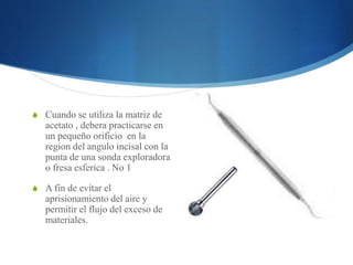 S Cuando se utiliza la matriz de 
acetato , debera practicarse en 
un pequeño orificio en la 
region del angulo incisal con la 
punta de una sonda exploradora 
o fresa esferica . No 1 
S A fin de evitar el 
aprisionamiento del aire y 
permitir el flujo del exceso de 
materiales. 
 