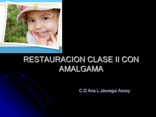 RESTAURACION CLASE II CON AMALGAMA C.D Ana L.JáureguiAscoy 