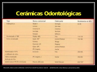 Cerámicas Odontológicas RIELSON JOSE ALVES CARDOSO. ESTETICA ODONTOLOGICA, NUEVA  GENERACION. Artes Médicas Latinoamérica.2004. 
