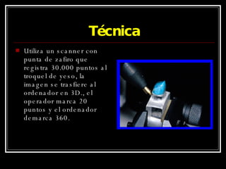 Técnica Utiliza un scanner con punta de zafiro que registra 30.000 puntos al troquel de yeso, la imagen se trasfiere al ordenador en 3D., el operador marca 20 puntos y el ordenador demarca 360. 