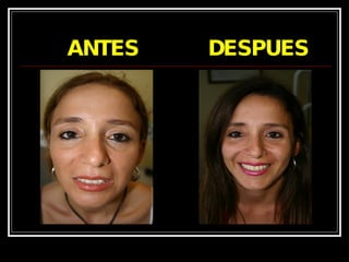 ANTES  DESPUES 