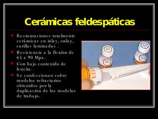 Cerámicas feldespáticas Restauraciones totalmente cerámicas en inlay, onlay, carillas laminadas . Resistencia a la flexión de 65 a 90 Mpa. Con bajo contenido de leucita. Se confeccionan sobre modelos refractarios obtenidos por la duplicación de los modelos de trabajo. 