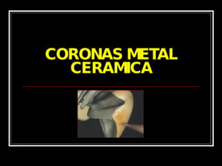 CORONAS METAL CERAMICA 