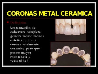 CORONAS METAL CERAMICA Definición Restauración de cobertura completa generalmente menos estética que una corona totalmente cerámica pero que posee mayor resistencia y versatilidad. 