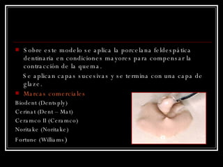 Sobre este modelo se aplica la porcelana feldespática dentinaria en condiciones mayores para compensar la contracción de la quema.  Se aplican capas sucesivas y se termina con una capa de glaze. Marcas comerciales Biodent (Dentsply) Cerinat (Dent – Mat) Ceramco II (Ceramco) Noritake (Noritake) Fortune (Williams ) 