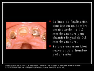 La línea de finalización consiste en un hombro vestibular de 1 a 1.2 mm de anchura y un chamfer lingual de 0.5 mm de anchura.  Se crea una transición suave entre el hombro y el chamfer. HISAKA SHIRATSUCHI, DDS Et al. INFLUENCE OF FINISH LINE DESIGN ON MARGINAL ADAPTATION OF ELECTROFORMED METAL – CERAMIC CROWNS. J Prosthet Dent 2006; 95:237 -42 