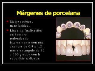 Márgenes de porcelana Mejor estética, translucidez. Línea de finalización en hombro redondeado internamente con una anchura de 0.8 a 1.2 mm y en ángulo de 90 a 100 grados con la superficie radicular. 