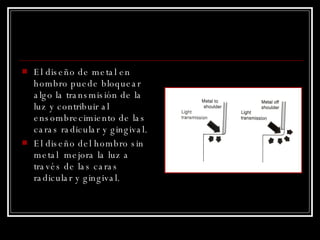 El diseño de metal en hombro puede bloquear algo la transmisión de la luz y contribuir al ensombrecimiento de las caras radicular y gingival. El diseño del hombro sin metal  mejora la luz a través de las caras radicular y gingival. 