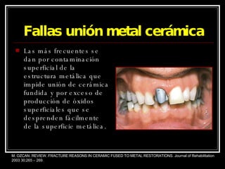 Fallas unión metal cerámica Las más frecuentes se dan por contaminación superficial de la estructura metálica que impide unión de cerámica fundida y por exceso de producción de óxidos superficiales que se desprenden fácilmente de la superficie metálica. M. OZCAN. REVIEW. FRACTURE REASONS IN CERAMIC FUSED TO METAL RESTORATIONS. Journal of Rehabilitation 2003 30;265 – 269. 