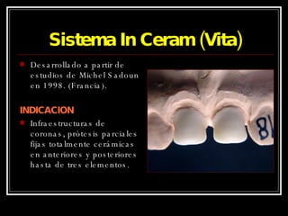 Sistema In Ceram (Vita) Desarrollado a partir de estudios de Michel Sadoun en 1998. (Francia). INDICACION Infraestructuras de coronas, prótesis parciales fijas totalmente cerámicas en anteriores y posteriores hasta de tres elementos. 