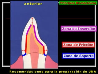 Recomendaciones para la preparación de UNA CORONA anterior Principios Biomecánicos Zona de Inserción Zona de Fricción Zona de Soporte 