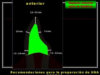 Recomendaciones para la preparación de UNA CORONA 1.5 – 2.0 mm. 1.5 – 2.0 mm. 2.0 mm. 2.0 - 2.5 mm. 1.5 mm. anterior Espacio mínimo para la Estética 