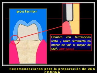 Hombro con terminación recta y canto semirrecto no menor de 90 ° ni mayor de 120°.  (100° Aprox.) posterior Recomendaciones para la preparación de UNA CORONA 
