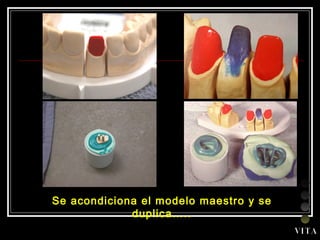 Se acondiciona el modelo maestro y se duplica….. V I T A 