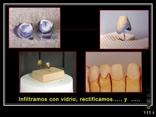 Infiltramos con vidrio, rectificamos….. y  …..  V I T A 
