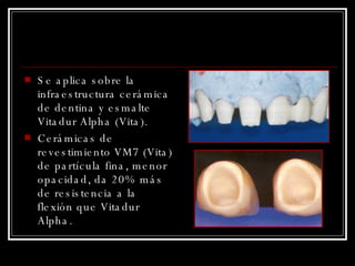 Se aplica sobre la infraestructura cerámica de dentina y esmalte Vitadur Alpha (Vita). Cerámicas de revestimiento VM7 (Vita) de partícula fina, menor opacidad, da 20% más de resistencia a la flexión que Vitadur Alpha. 