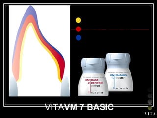 VITA VM 7 BASIC V I T A Estructura de ceramica sin metal VITAVM 7 Dentina base VITAVM 7 Enamel  
