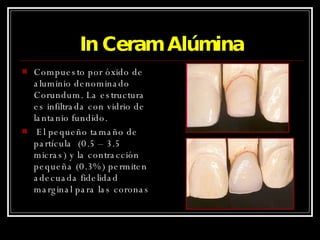 In Ceram Alúmina Compuesto por óxido de aluminio denominado Corundum. La estructura es infiltrada con vidrio de lantanio fundido. El pequeño tamaño de partícula  (0.5 – 3.5 micras) y la contracción pequeña (0.3%) permiten adecuada fidelidad marginal para las coronas  