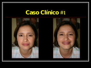 Caso Clínico #1 