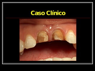 Caso Clínico 