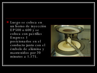 Luego se coloca en un horno de inyección EP500 o 600 y se coloca con pastillas Empress 1 posicionados en el conducto junto con el émbolo de alúmina y mantenidos por 20 minutos a 1.175. 