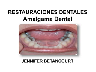 RESTAURACIONES DENTALES 
Amalgama Dental 
JENNIFER BETANCOURT 
 