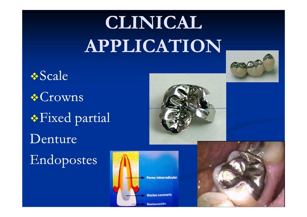 DENTISTRY (Metallic Restorations)