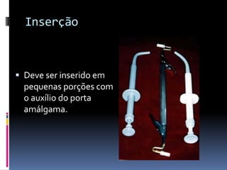 Inserção



 Deve ser inserido em
  pequenas porções com
  o auxílio do porta
  amálgama.
 