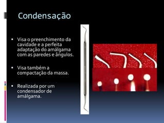Condensação

 Visa o preenchimento da
  cavidade e a perfeita
  adaptação do amálgama
  com as paredes e ângulos.

 Visa também a
  compactação da massa.

 Realizada por um
  condensador de
  amálgama.
 
