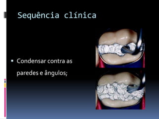 Sequência clínica




 Condensar contra as
  paredes e ângulos;
 