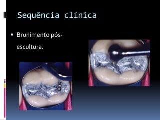 Sequência clínica

 Brunimento pós-
 escultura.
 