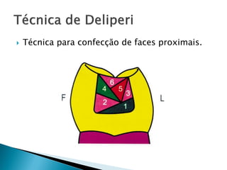  Técnica para confecção de faces proximais.
 