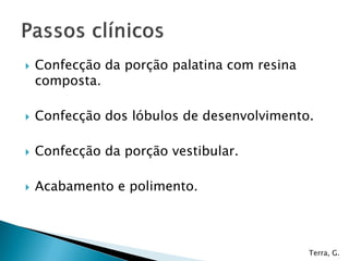    Confecção da porção palatina com resina
    composta.

   Confecção dos lóbulos de desenvolvimento.

   Confecção da porção vestibular.

   Acabamento e polimento.



                                              Terra, G.
 