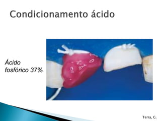 Ácido
fosfórico 37%




                Terra, G.
 