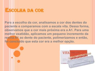 ESCOLHA DA COR
Para a escolha da cor, analisamos a cor dos dentes do
paciente e comparamos com a escala vita. Dessa forma,
observamos que a cor mais próxima era a A1. Para uma
melhor exatidão, aplicamos um pequeno incremento da
resina A1 ao dente do paciente, polimerizamos e então,
foi concluído que esta cor era a melhor opção.
 