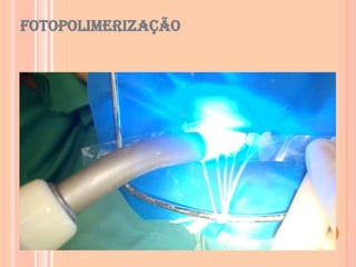 Fotopolimerização
 