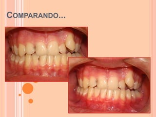 COMPARANDO...
 