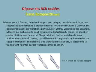 Dépose des RCR coulées
Fraise Rotopro(Ellman)
Existant sous 4 formes, la fraise Rotopro est conique, possède ses 6 faces non
coupantes et fonctionne à grande vitesse : lors d'une rotation d'un tour, ses
bords produisent six vibrations par tour, soit 20 000 vibrations par seconde.
Montée sur turbine, elle peut entraîner la libération du tenon, en étant en
contact intime avec le métal. Elle produit un frottement dans le sens
antihoraire autour du tenon, parallèlement à son grand axe. La création de
cette vibration est semblable à une vibration ultrasonore, la vitesse de la
fraise étant ralentie par les frictions contre le tenon.
Les 4 types de fraises Rotopro
 