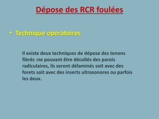 Dépose des RCR foulées
• Technique opératoires
Il existe deux techniques de dépose des tenons
fibrés :ne pouvant être décollés des parois
radiculaires, ils seront délaminés soit avec des
forets soit avec des inserts ultrasonores ou parfois
les deux.
 