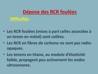 Dépose des RCR foulées
Difficultés :
• Les RCR foulées (mises à part celles associées à
un tenon en métal) sont collées.
• Les RCR en fibres de carbone ne sont pas radio-
opaques.
• Les tenons en titane, au module d’élasticité
faible, propagent peu activement les ondes
ultrasonores.
 
